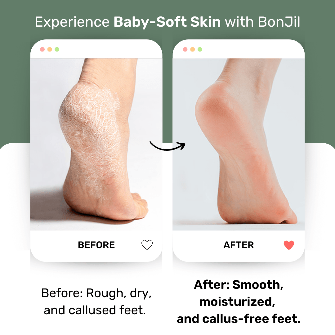 Expert Set | Foot File + Callus Softener + Foot Balm